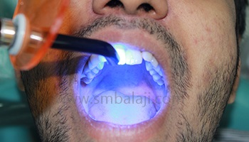 Cosmetic dentistry & Smile designing