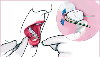 Preventive Dentistry | Complete Prevention Program