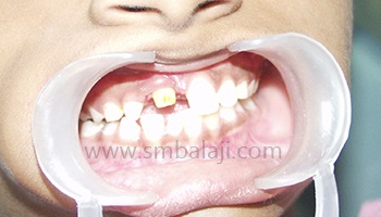 Kidz Korner | Specialized dentistry for kids