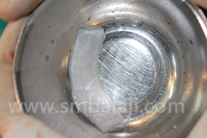 BMP and Dental Implants 4 rhBMP-2