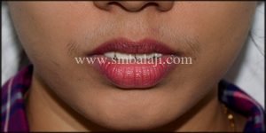 best jaw surgeon in india