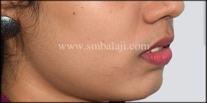 best corrective jaw surgeon in india