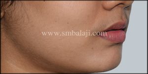 best jaw surgeon in india