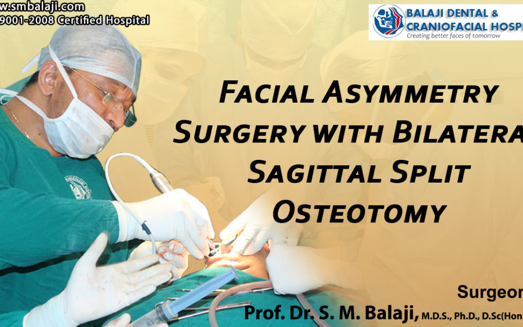 Facial Asymmetry Surgery with Bilateral Sagittal Split Osteotomy