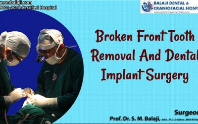 Broken Front Tooth Removal and Dental Implant Surgery