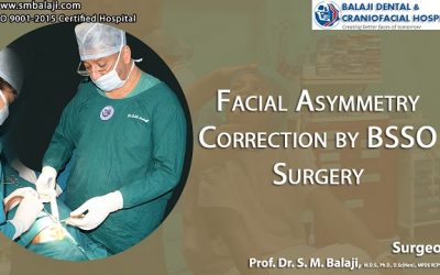 Facial Asymmetry Correction by BSSO Surgery