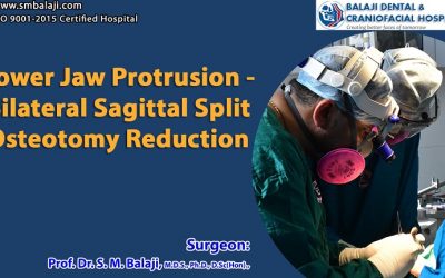 Lower Jaw Protrusion – Bilateral Sagittal Split Osteotomy Reduction