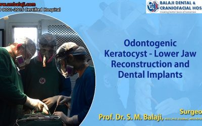 Odontogenic Keratocyst – Jaw Reconstruction and Dental Implants
