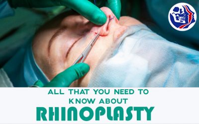 All That You Need to Know About Rhinoplasty