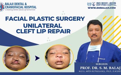 Facial Plastic Surgery – Unilateral Cleft Lip Repair
