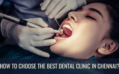 How to Choose the Best Dental Clinic in Chennai?