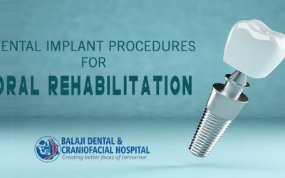 Dental Implant Procedures for Oral Rehabilitation