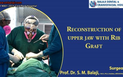 Reconstruction of upper jaw with Rib Graft