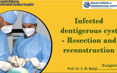 Infected dentigerous cyst – Resection and reconstruction