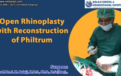 Open Rhinoplasty with reconstruction of philtrum