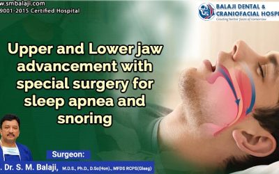 Upper and Lower Jaw Advancement with Special Surgery for Sleep Apnea and Snoring
