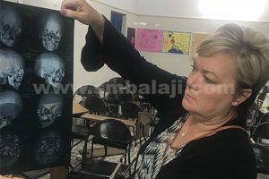 Tensor fascia lata graft obtained from the vastus lateralis muscle