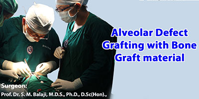 Alveolar defect grafting with bone graft material
