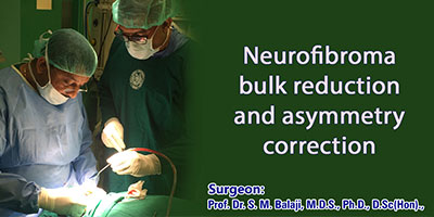 Neurofibroma bulk reduction and asymmetry correction