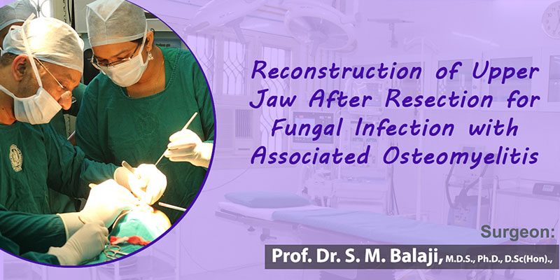 Reconstruction of Upper Jaw After Resection for Fungal Infection with Associated Osteomyelitis